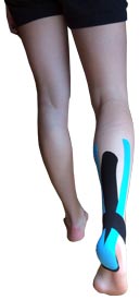 Achilles Tendonitis Taping