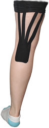 Back of Knee Taping