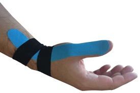 De Quervain&rsquo;s Taping