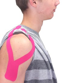 Deltoid Taping
