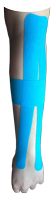 Extensor Tendonitis Taping