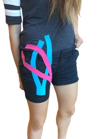 Hip Flexor Taping