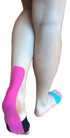 Metatarsalgia Taping