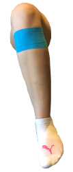 Osgood-Schlatter Taping
