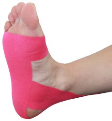 Plantar Fasciitis Taping