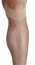 Patellar Tendonitis Taping