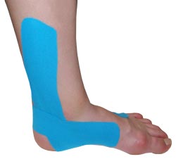 Peroneal Taping