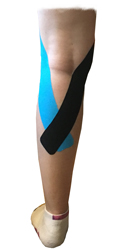Popliteus Muscle Taping