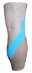 Popliteus Muscle Taping