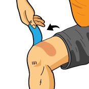 Possible Side Effect of Temporary Redness