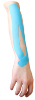 Forearm Extensor Tendonitis Taping