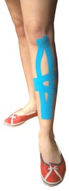 Shin Splint Taping