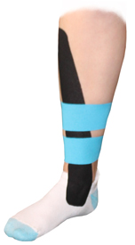 Tibialis Anterior Tendonitis Taping