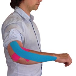 Tennis Elbow Taping