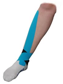 Tibialis Anterior Tendonitis Taping