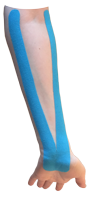 Inner Forearm Taping